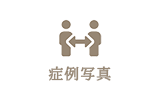 症例写真